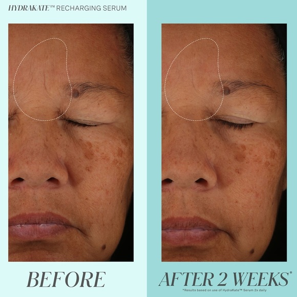 💦 Kate Somerville HydraKate Recharging Serum - Picture 4 of 11